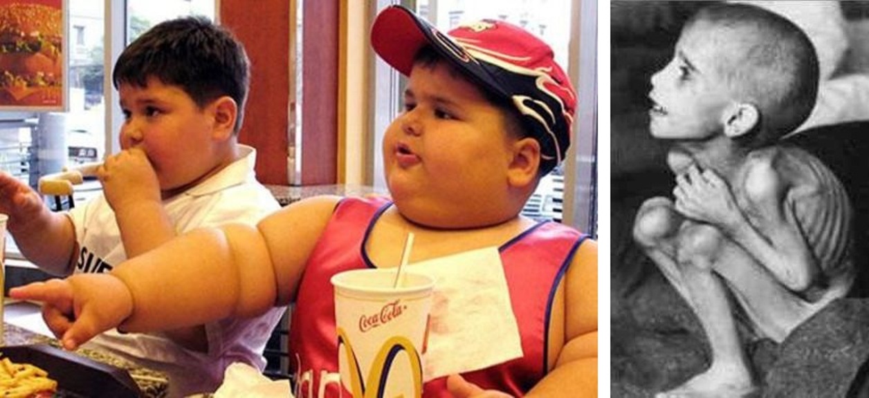 ανθυγιεινη_υποσιτισμός